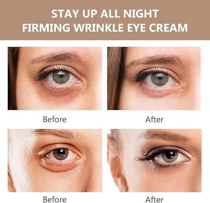 Instant FIRMx Eye Tightener & Eye Bag Cream (BUY 1 GET 1 FREE!)